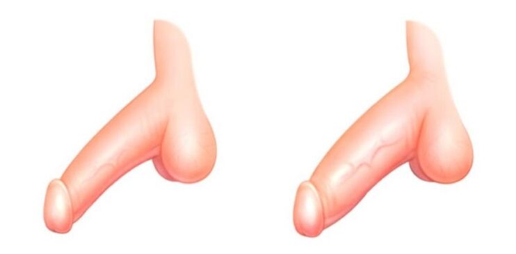 Člen pred a po zvýšení